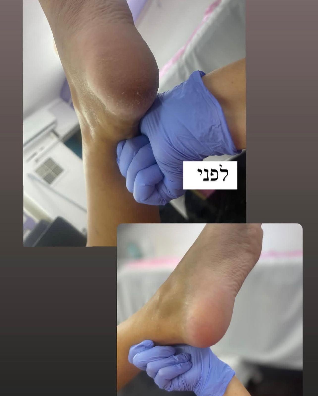 פדיקור קלאסי